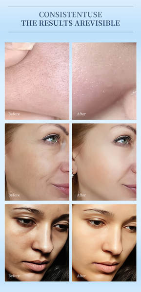 Moisturizing & Hydrating Face Cream para o rosto